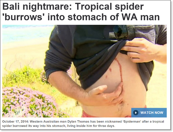 http://www.9news.com.au/world/2014/10/16/17/56/tropical-spider-burrows-into-stomach-of-wa-man